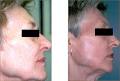 Woo Tom Dr Laser & Dermatology image 2