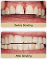 Arista Dentist Guelph - Cosmetic, Whitening, Invisalign, Emergency image 2