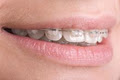 Arista Dentist Guelph - Cosmetic, Whitening, Invisalign, Emergency image 5