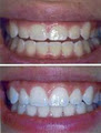 Arista Dentist Guelph - Cosmetic, Whitening, Invisalign, Emergency image 1