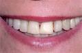 Beacon Hill Dental image 3