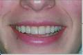 Beacon Hill Dental image 6