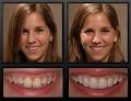 Appleway Dental CLinic@Stettler image 3