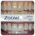 Crowfoot Dental image 4