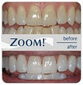Crowfoot Dental image 5