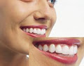 Dr. Larry Lu Inc. | Surrey Dental Clinic, Cosmetic Dentists Surrey image 2