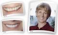 Dr. Larry Lu Inc. | Surrey Dental Clinic, Cosmetic Dentists Surrey image 4