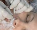 Elite Electrolysis Clinic image 1
