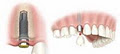 Milton Dentist - Arista Dental Centers image 2