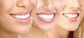 Milton Dentist - Arista Dental Centers image 3