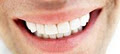 Milton Dentist - Arista Dental Centers image 4