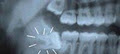 Milton Dentist - Arista Dental Centers image 1