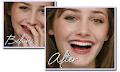 Minuk Denture Clinic & Dental Implant Centre image 6