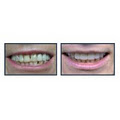 Molson Park Dental Office - Dr. Adam Chapnick image 2