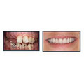 Molson Park Dental Office - Dr. Adam Chapnick image 3