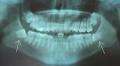 Oshawa Dentist - Cosmetic, Invisalign, Zoom Whitening, Emergency image 2