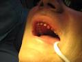 Rosedale Family Dental Care-Toronto Dentist image 6