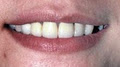 Simon Dental Care - Dental Clinic & Surgery image 5