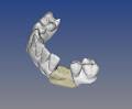 5 Axis Dental Design Center image 5