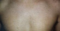 Adora Skin Laser Clinic image 4