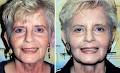 Age Reversing Dermatology image 2