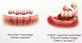 Allcare Denture Clinic image 2