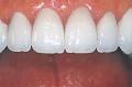 Aurum Ceramic Dental Laboratories (BC) Ltd image 5