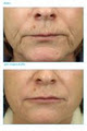Beauti-Med Laser Skin Care Centre image 6