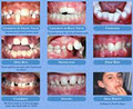 Brantford Orthodontist/TMJ/ TMJ Prevention - Dr. Vic Schacher image 2