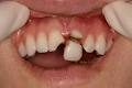 Burnaby Dentist-Dr. Mark Kwon Chrysalis Implant Dental image 2