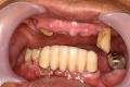 Burnaby Dentist-Dr. Mark Kwon Chrysalis Implant Dental image 3