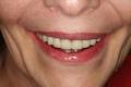 Burnaby Dentist-Dr. Mark Kwon Chrysalis Implant Dental image 4