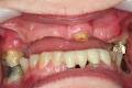 Burnaby Dentist-Dr. Mark Kwon Chrysalis Implant Dental image 6