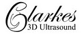 Clarkes 3D Ultrasound image 1