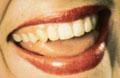 Cosmetic And Emergency Denture Clinic image 6