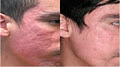 Dermacure - Laser Hair Removal - Medical SPA & Skin Care image 2