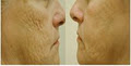 Dermacure - Laser Hair Removal - Medical SPA & Skin Care image 3