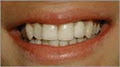 Dr. Frederick Li - Dental Implant image 2