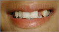Dr. Frederick Li - Dental Implant image 3