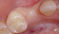 Dr. Frederick Li - Dental Implant image 4
