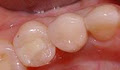 Dr. Frederick Li - Dental Implant image 5
