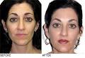 Dr. Karen O'Neill, Cosmetic Dermatologist image 6