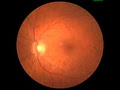 Dr. Shalu Pal Optometrist, Eye Doctor & Keratoconus Toronto image 2