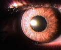 Dr. Shalu Pal Optometrist, Eye Doctor & Keratoconus Toronto image 3