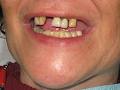 Envision Denture and Implant Centre image 5