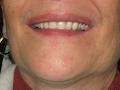 Envision Denture and Implant Centre image 6