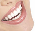 Erbsville Dental Clinic - Bridges, Invisalign, Orthodontists Services image 1