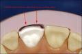 FX Veneers Dental Laboratory Inc. image 2