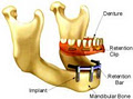 Hespeler Denture Clinic image 3