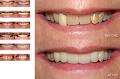 Humber Valley Dental image 2